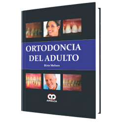 Ortodoncia del Adulto
