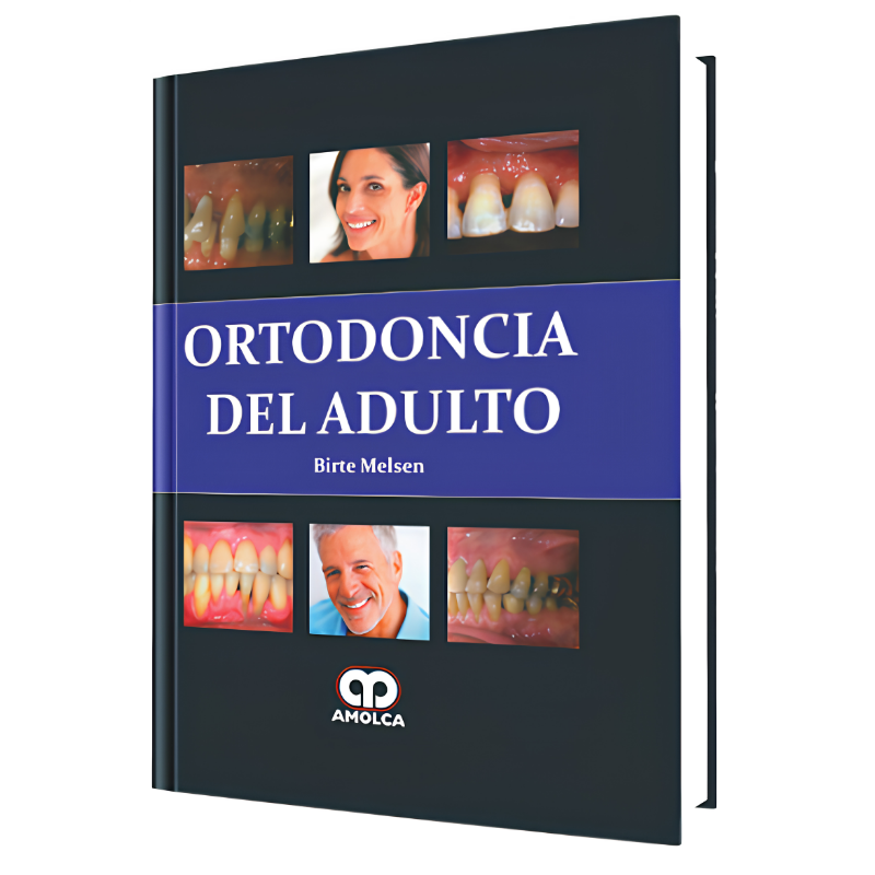 Ortodoncia del Adulto