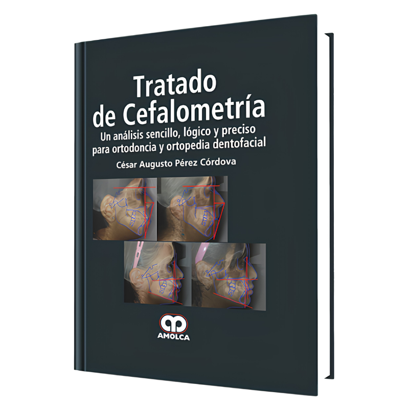 Tratado de Cefalometría