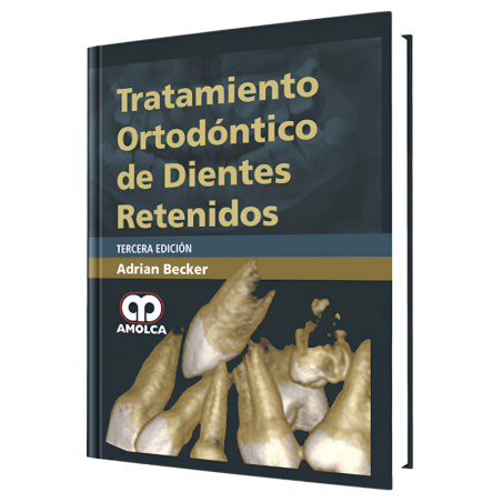 Tratamiento Ortodóntico de los Dientes Retenidos. 3 Edición