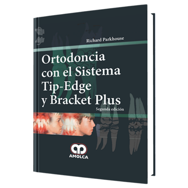 Ortodoncia con el Sistema Tip-Edge y Bracket Plus. 2 Edición