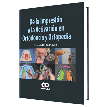 De la Impresión a la Activación en Ortodoncia y Ortopedia