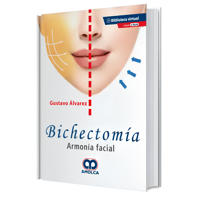 Bichectomía. Facial harmony