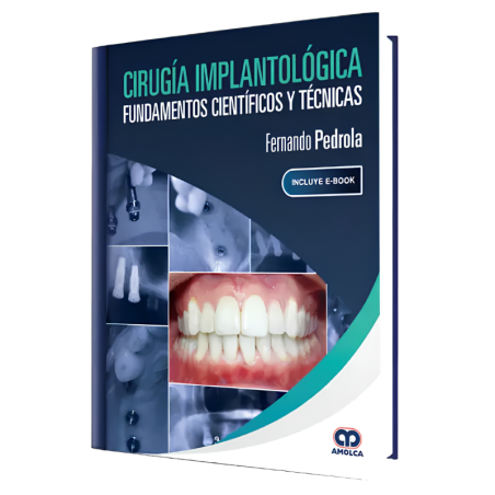 Cirugía Implantológica. Fundamentos Científicos y Técnicas