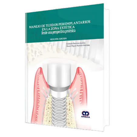 Manejo de Tejidos Periimplantarios en la Zona Estética. Desde una Perspectiva Protésica. 2 edición