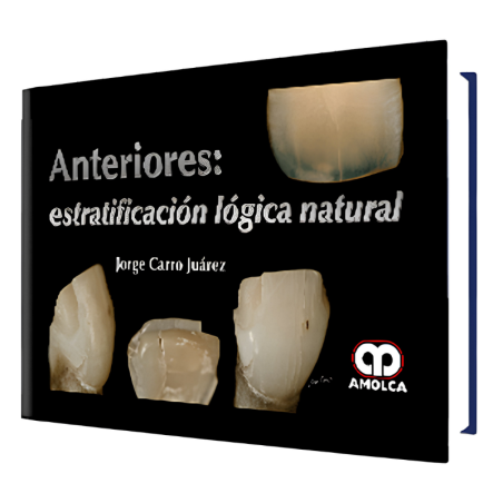 Previous: natural logic stratification