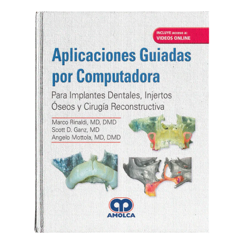 Aplicaciones Guiadas por Computadora