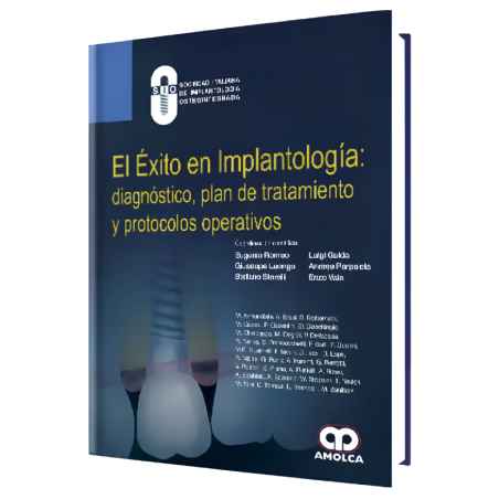 Success in implantology: diagnosis, treatment plan and operating protocols