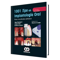 1001 Tips en Implantología Oral