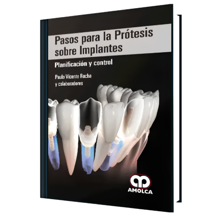 Steps for prostheses on implants