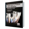 Steps for prostheses on implants