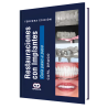 Restorations with implants. Step by step guide. 3 edition