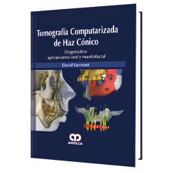 Conical beam computed tomography