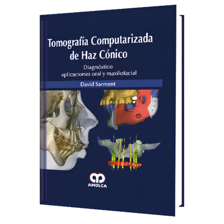 Tomografía Computarizada de Haz Cónico