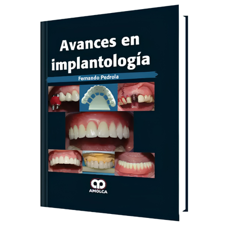Advances in Implantology