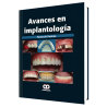 Advances in Implantology