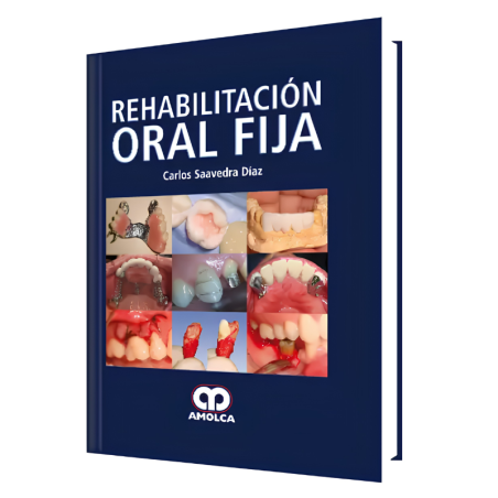 Fixed oral rehabilitation