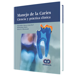 Management of cavities Science and clinical practice