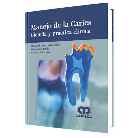 Management of cavities Science and clinical practice