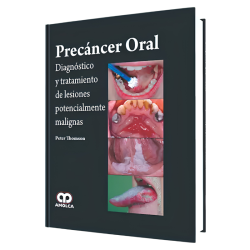 Precáncer Oral. Diagnóstico y Tratamiento de Lesiones Potencialmente Malignas
