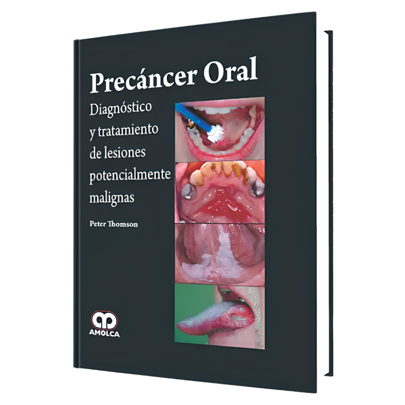 Precáncer oral. Diagnosis and treatment of potentially malignant lesions