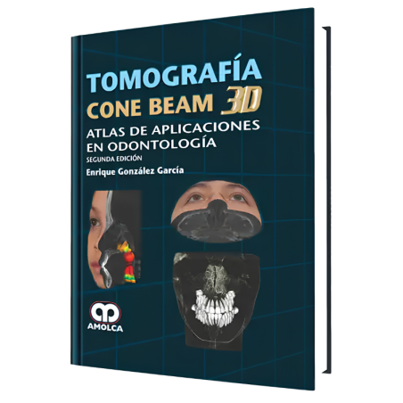 Tomography cone beam 3d. 2 edition