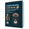 Tomography cone beam 3d. 2 edition