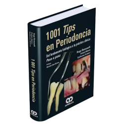 1001 Tips in Periodontics