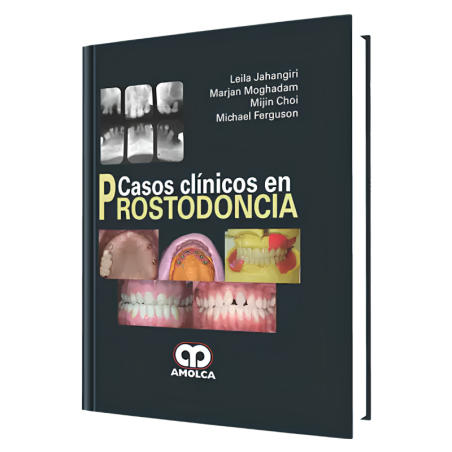 Clinical cases in Prostodontics