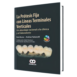 Fixed prosthesis with vertical terminal lines