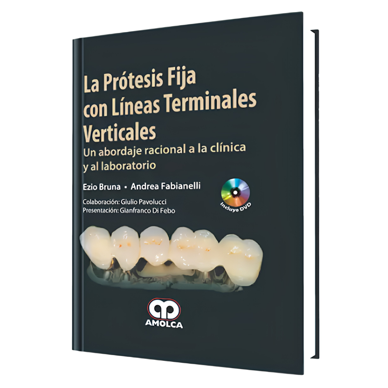 La Prótesis Fija con Líneas Terminales Verticales