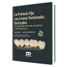 Fixed prosthesis with vertical terminal lines