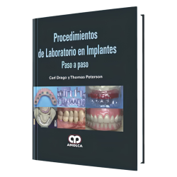 Laboratory procedures in step-by-step implants.