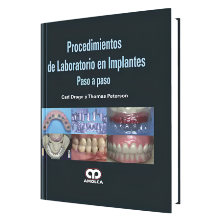 Laboratory procedures in step-by-step implants.