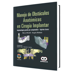 Management of anatomical obstacles in surgery Implant
