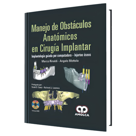 Manejo de Obstáculos Anatómicos en Cirugía Implantar