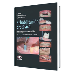Prosthetic rehabilitation. Removable partial prosthesis