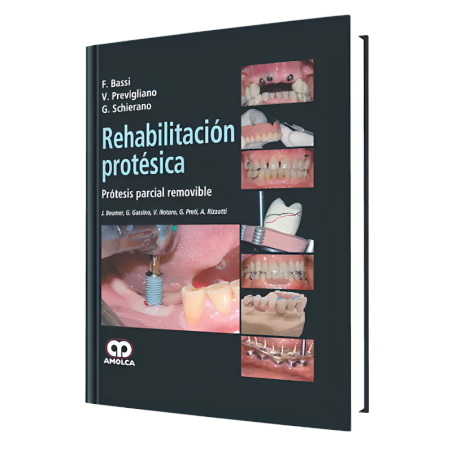 Prosthetic rehabilitation. Removable partial prosthesis