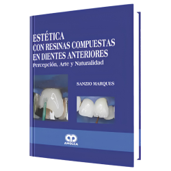 Aesthetics with resins composed of anterior teeth