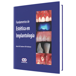 Fundamentals of aesthetics in Implantology