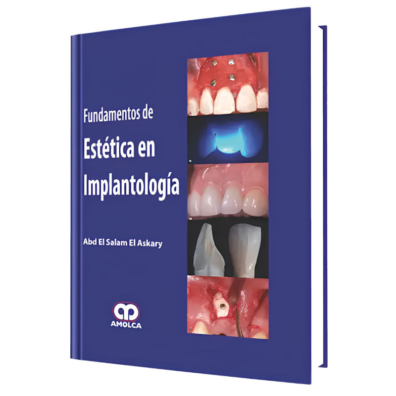 Fundamentos de Estética en Implantología
