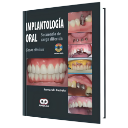 Oral implantology