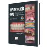 Oral implantology