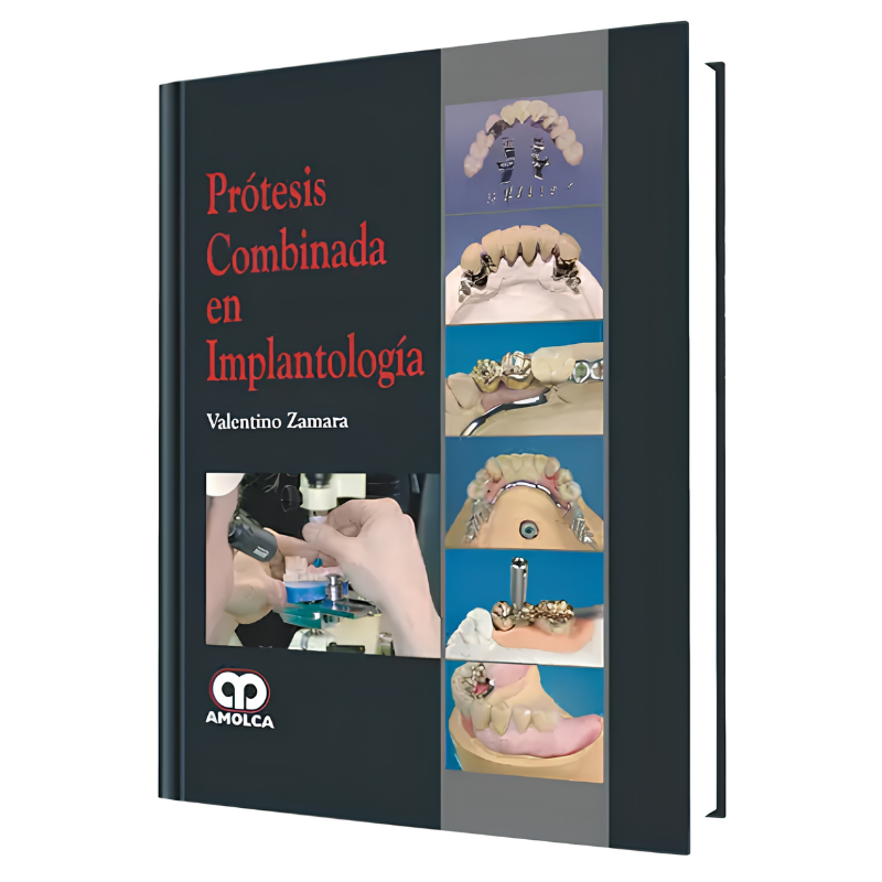 Combined prosthesis in Implantology