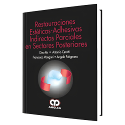 Restauraciones Estéticas-Adhesivas Indirectas Parciales en Sectores Posteriores