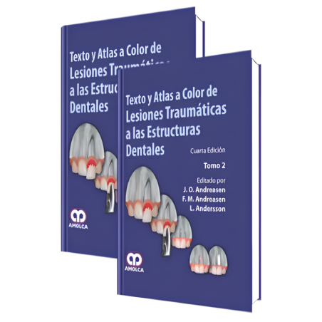 Texto y Atlas a Color de Lesiones Traumáticas a las Estructuras Dentales. 4 edición