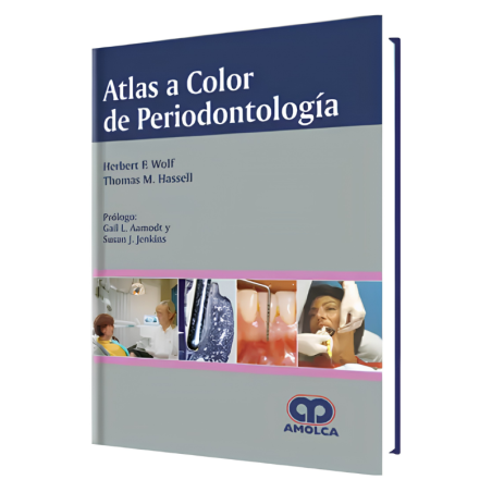 Color Atlas of Periodontology