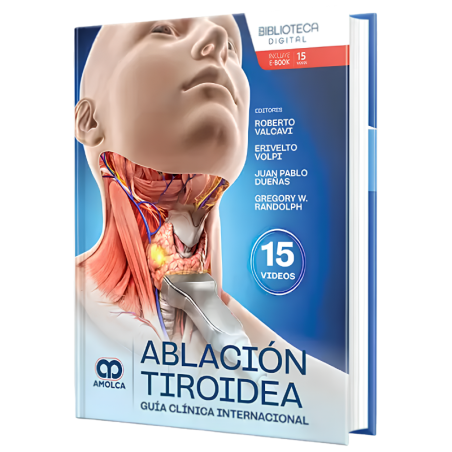 Thyroid ablation. International Clinical Guide