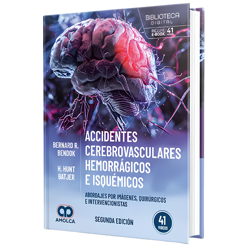 Accidentes cerebrovasculares hemorrágicos e isquémicos. Abordajes por imágenes, quirúrgicos e intervencionistas