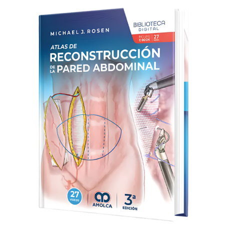 Atlas reconstruction of the abdominal wall